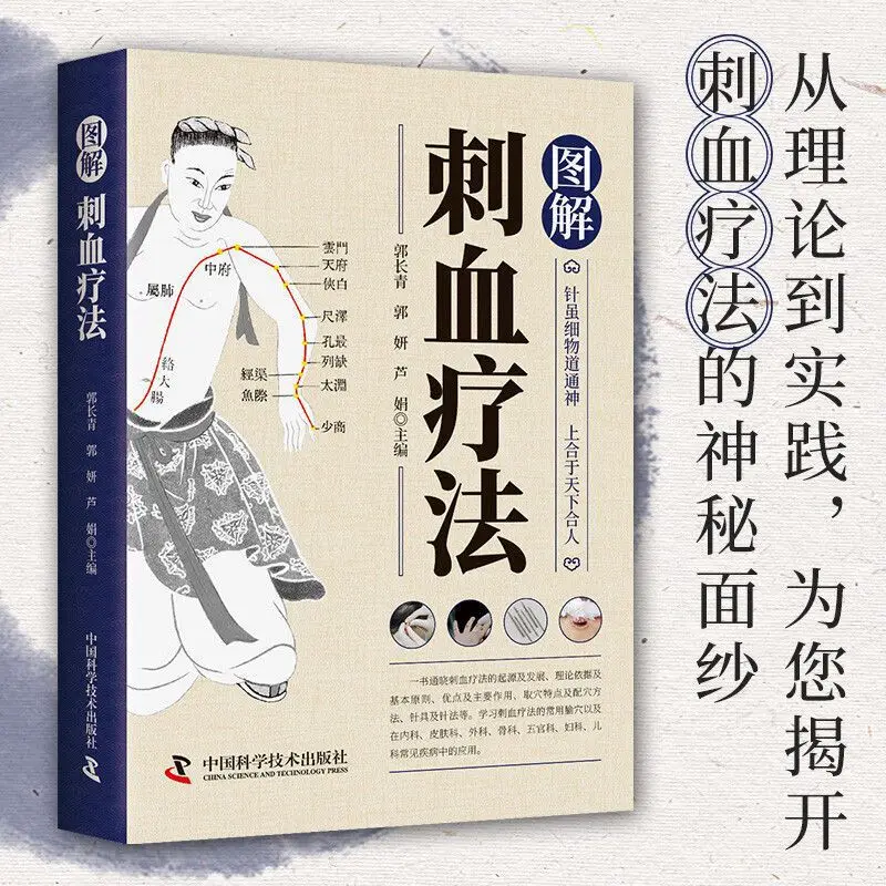 Bloodletting Therapy Explained - Therapy Health And Wellness 评论和价格